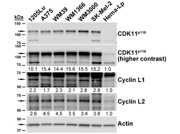 Western Blot using Cyclin L2